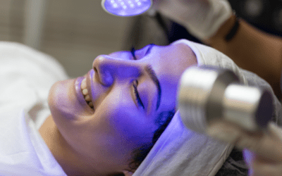 A Complete Guide to Laser Resurfacing in Los Angeles